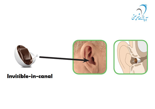 کلینیک آوای شریعتی-سمعک - Insio hearing aid 